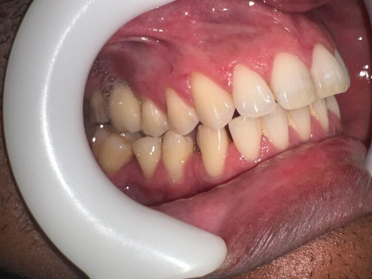 212f6ddf-ceab-45fc-b509-529940d3e4e8