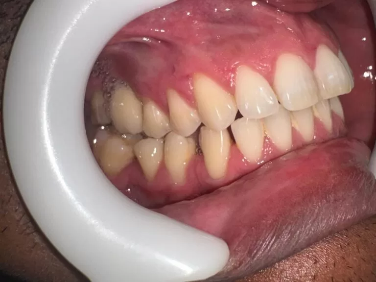 212f6ddf-ceab-45fc-b509-529940d3e4e8