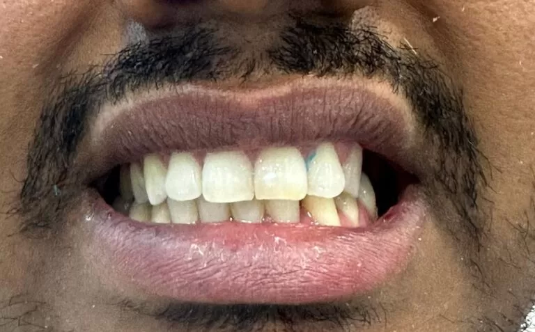 41f864d2-262e-4d85-9245-a41fc1ef2cd6